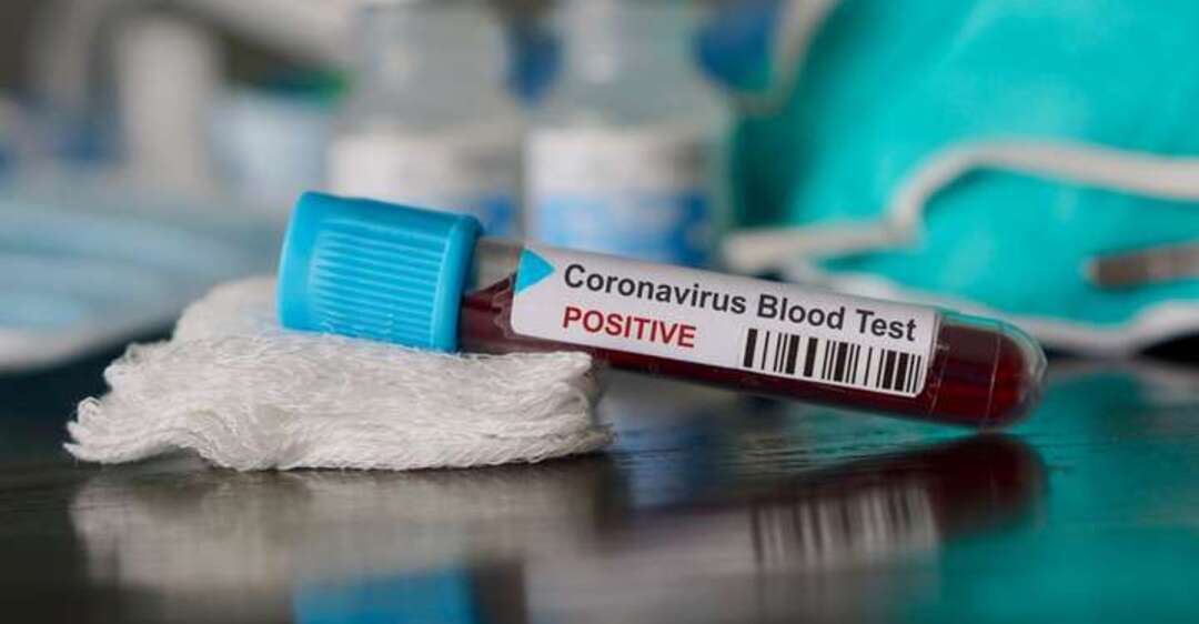 В Таиланде разработали экспресс-тест, определяющий коронавирус за полчаса