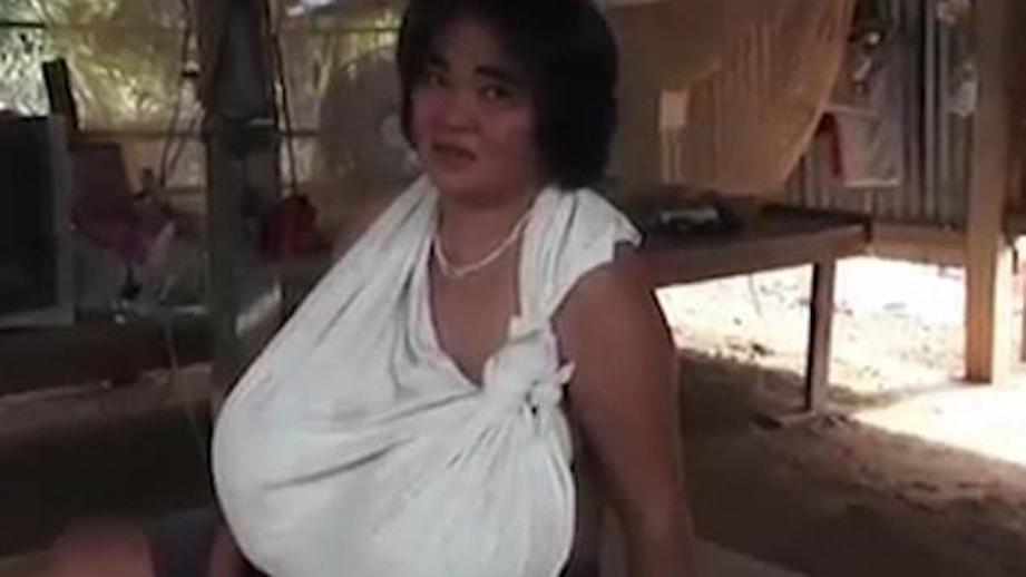 Огромная грудь измучила жительницу Таиланда