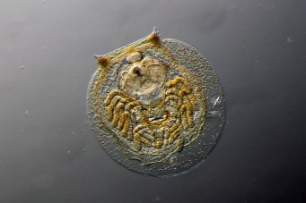 Шокирующие фото планктона под микроскопом (оказывается есть чем кусаться )