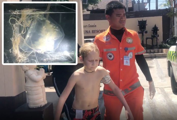 В Таиланде встреча с медузой закончилась плачевно для 10-летнего мальчика из России